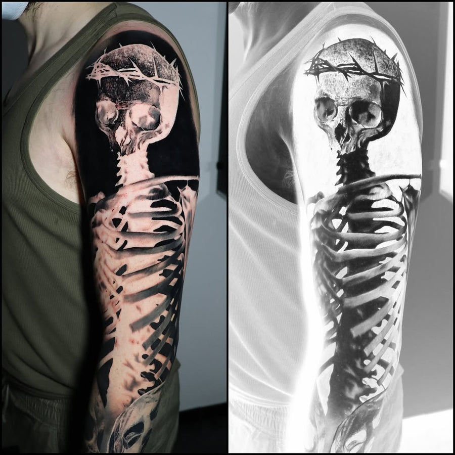 Skeleton
